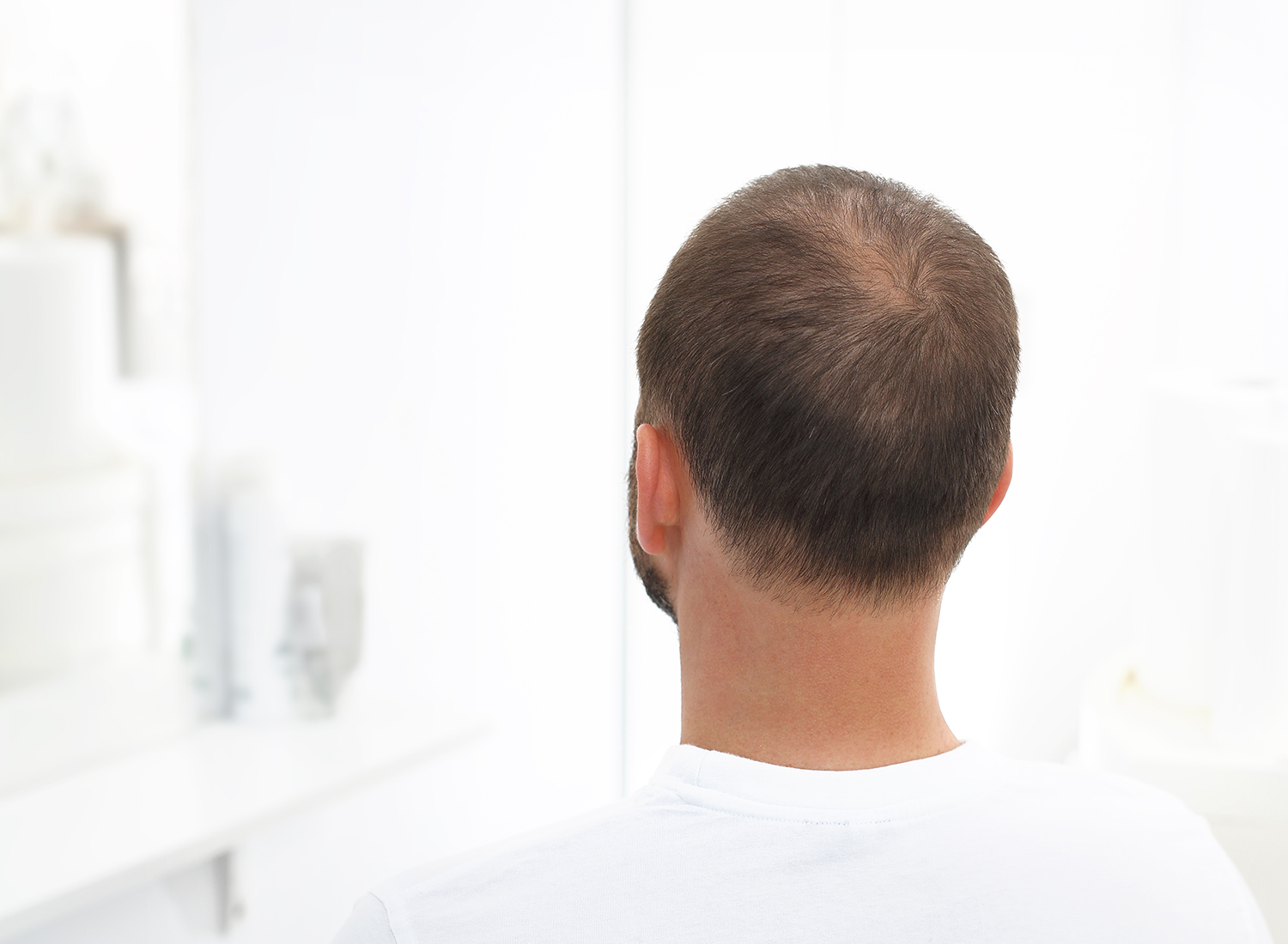 Using Regaine Solution for Reversing Androgenetic Alopecia in Males