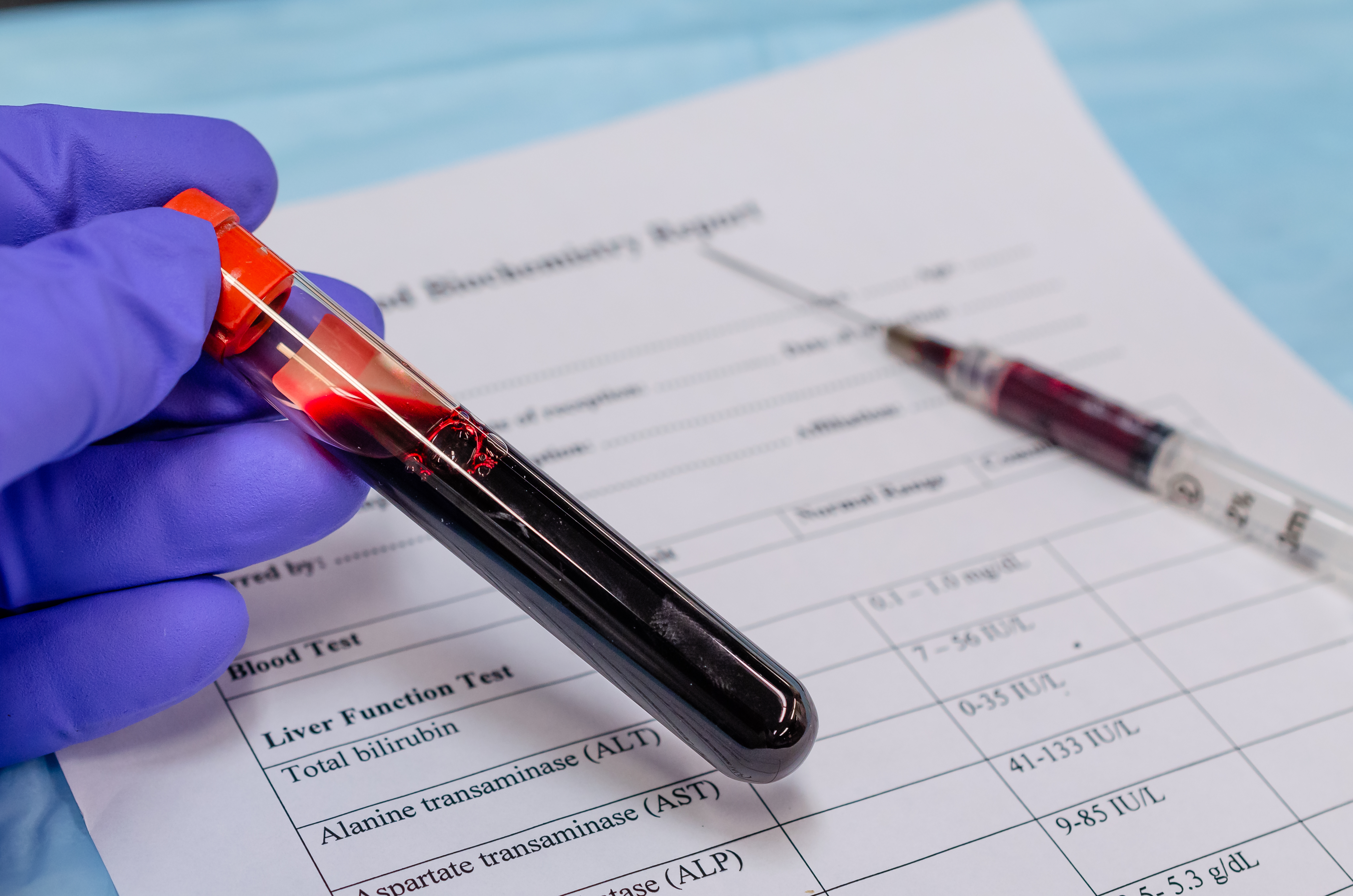 How to Interpret the Results of A Liver Health Blood Test?